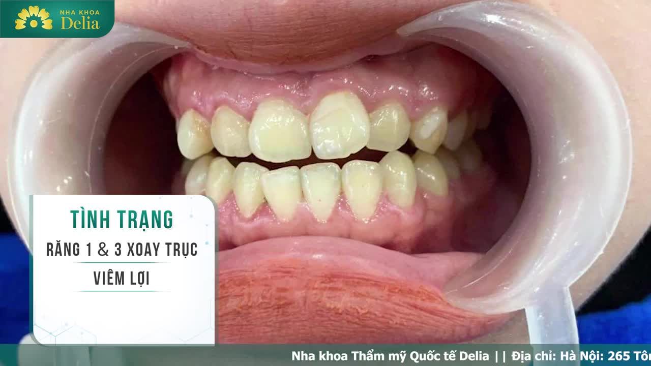 Khách hàng Hải Yến đến từ Quảng Ninh mong muốn cải thiện tình