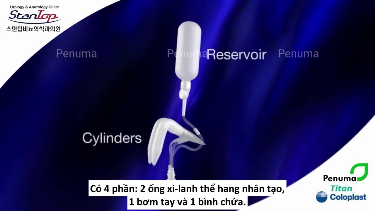 Video mô phỏng cơ chế hoạt động của thể hang nhân tạo giành cho người bị "liệt dương"