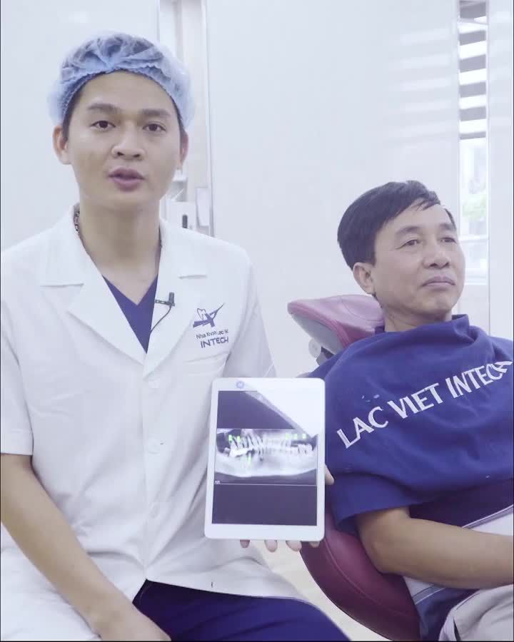 Lắp răng toàn hàm trên tại nha khoa Lạc Việt Intech