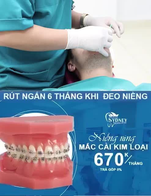 NIỀNG RĂNG KHÔNG KHÓ CHỈ CẦN BẠN CÓ QUYẾT TÂM