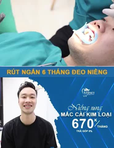 NIỀNG RĂNG KIM LOẠI - PHƯƠNG PHÁP HÔ BIẾN MỌI TÌNH TRẠNG RĂNG
