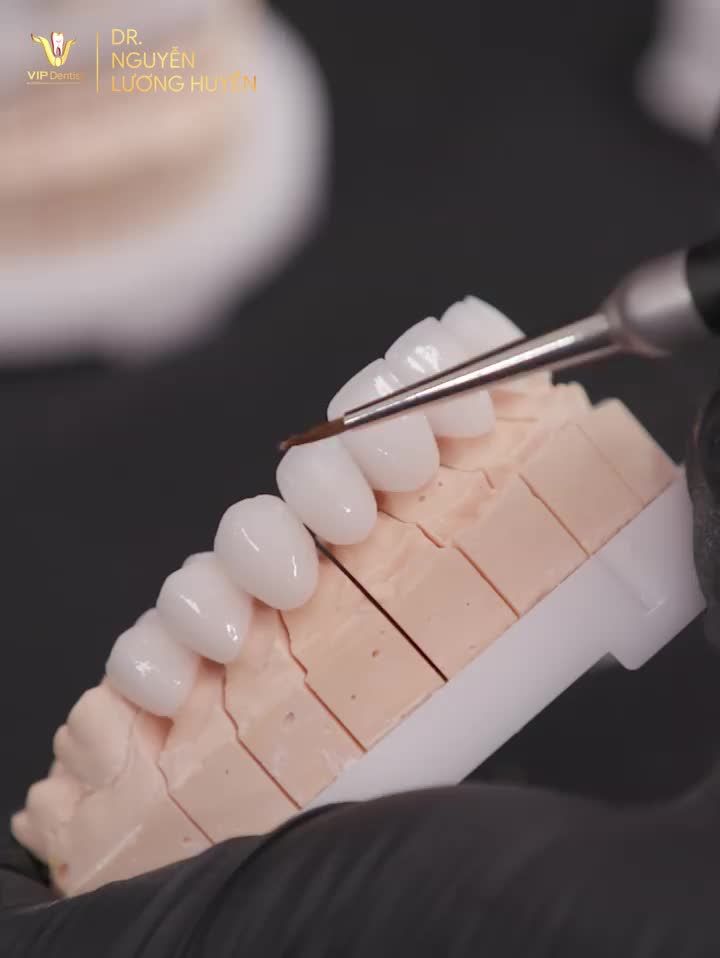 PHÔI SỨ VIP DENTIST - KẾT TINH CỦA CHUYÊN MÔN, KỸ THUẬT VÀ NGHỆ THUẬT