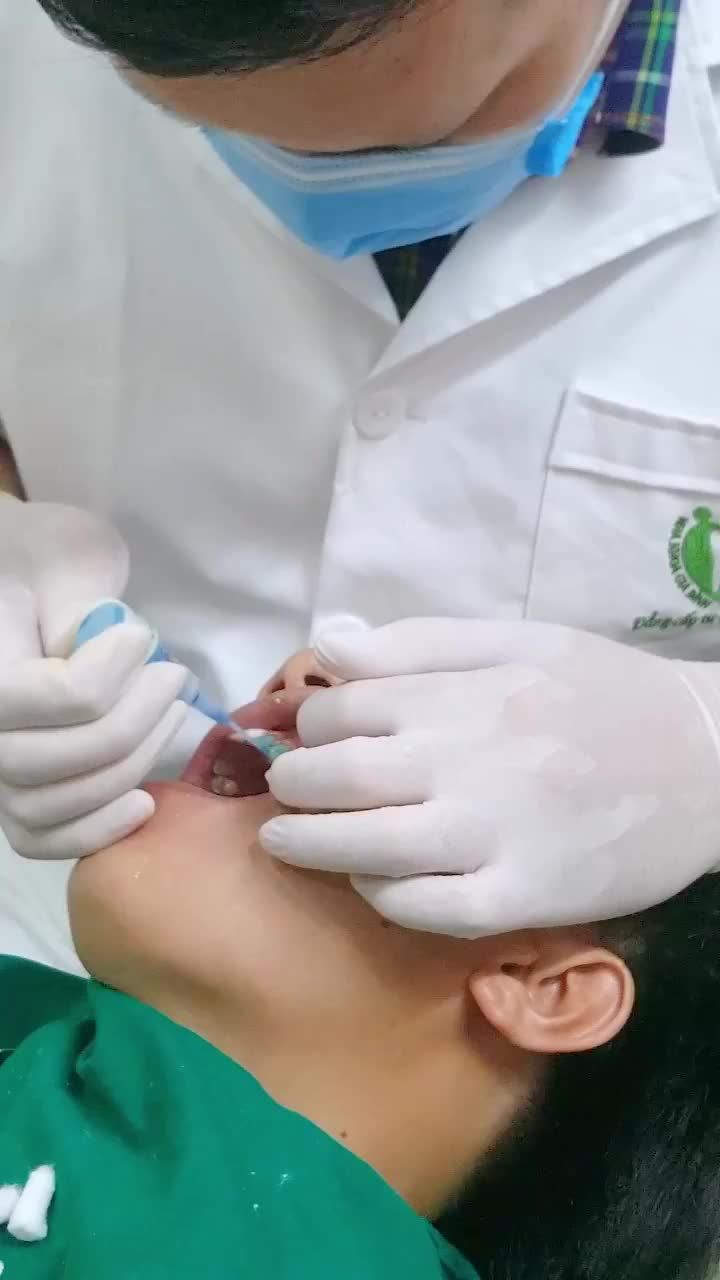 QUÁ TRÌNH THẨM MỸ RĂNG SỨ CỦA KHÁCH HÀNG