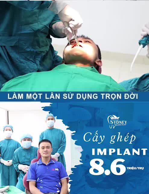 SAU CẤY GHÉP IMPLANT NÊN VÀ KHÔNG NÊN LÀM GÌ