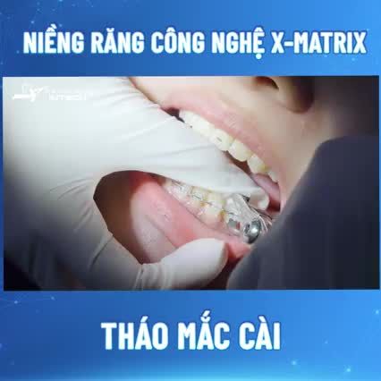THÁO MẮC CÀI – TỰ TIN VỚI NỤ CƯỜI MỚI