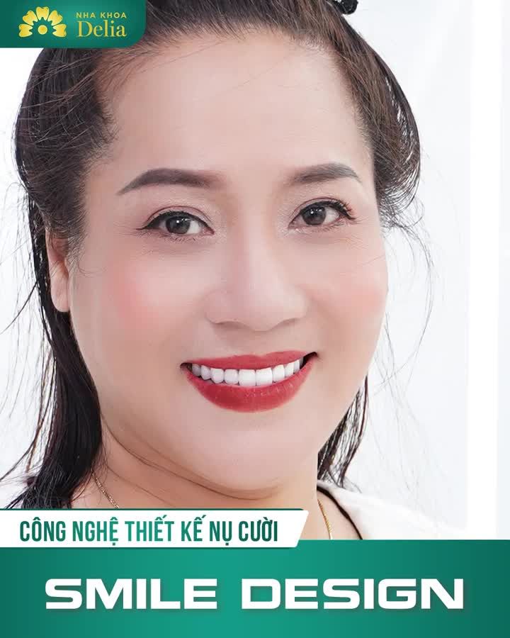 Theo chân Diễn Viên Thu Huyền trải nghiệm Thẩm mỹ răng sứ tại Delia