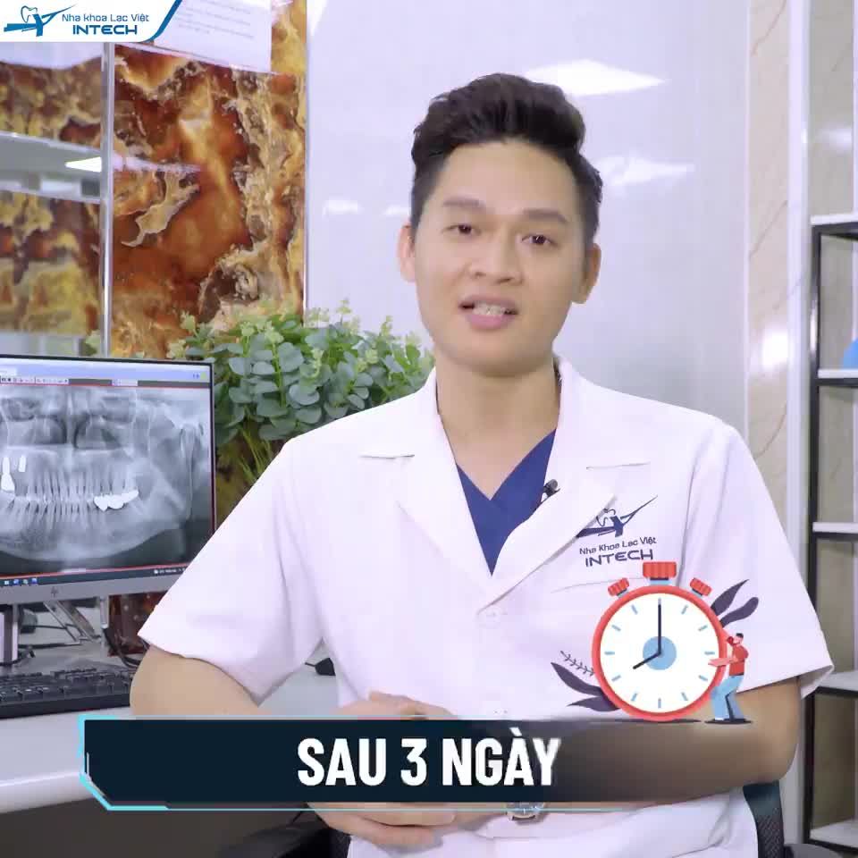 TRỒNG RĂNG IMPLANT BAO LÂU THÌ CÓ RĂNG ĂN NHAI