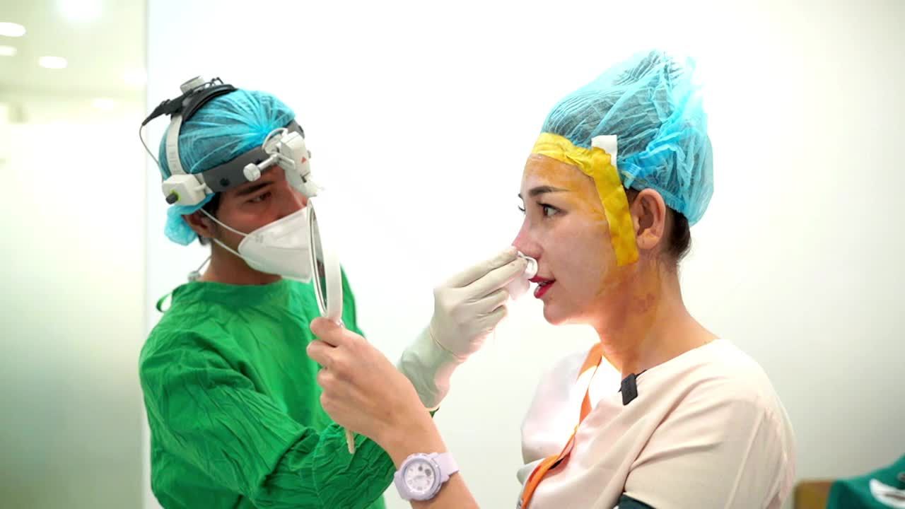 Ca nâng mũi cấu trúc