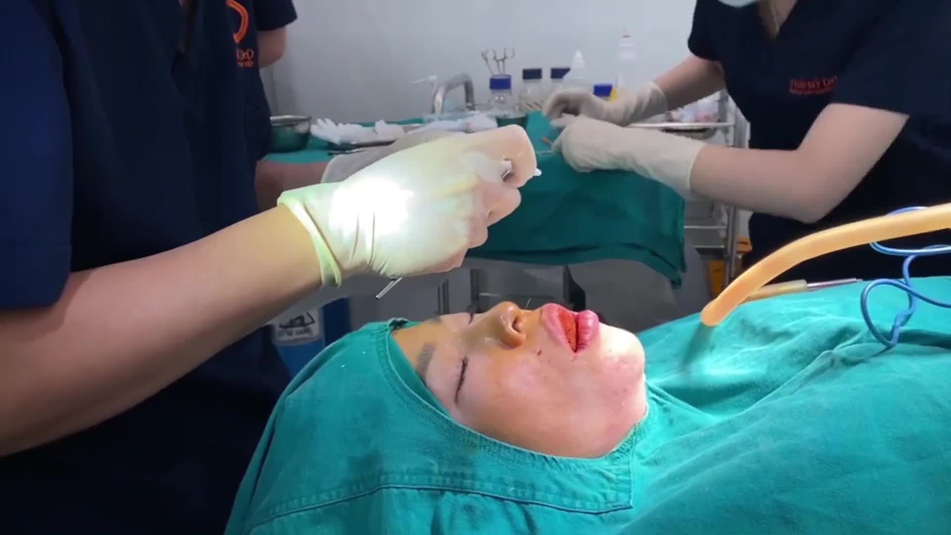 Độn cằm Vline - Dịch vụ được chị em lựa chọn thường xuyên tại Thẩm mỹ DrD.