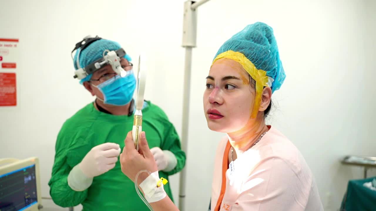 Ca nâng mũi cấu trúcc