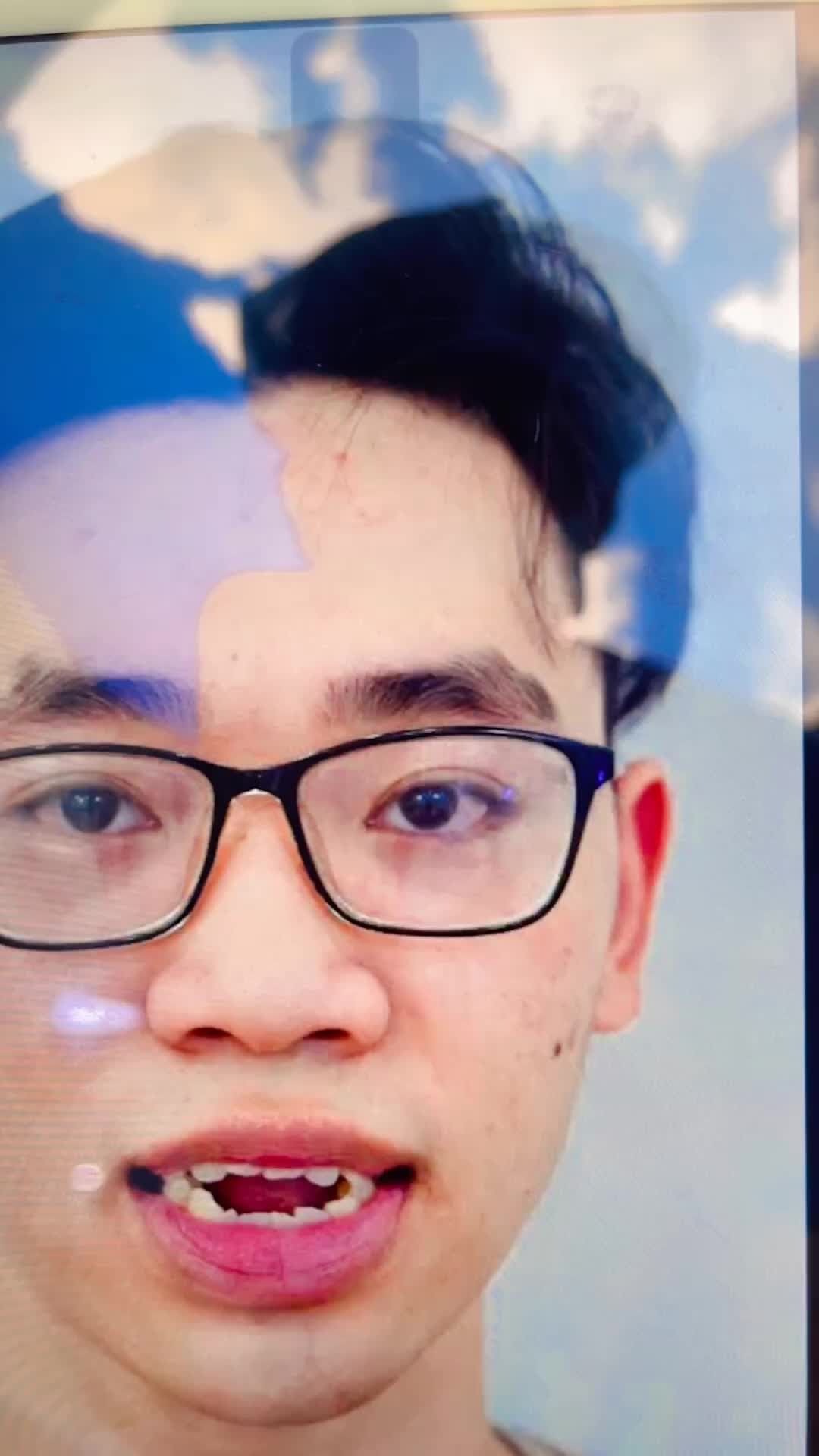 Cảm nhận của khách hàng sau 2 năm thực hiện dịch vụ niềng răng tại bệnh viện thẩm mỹ Kangnam Sài Gòn