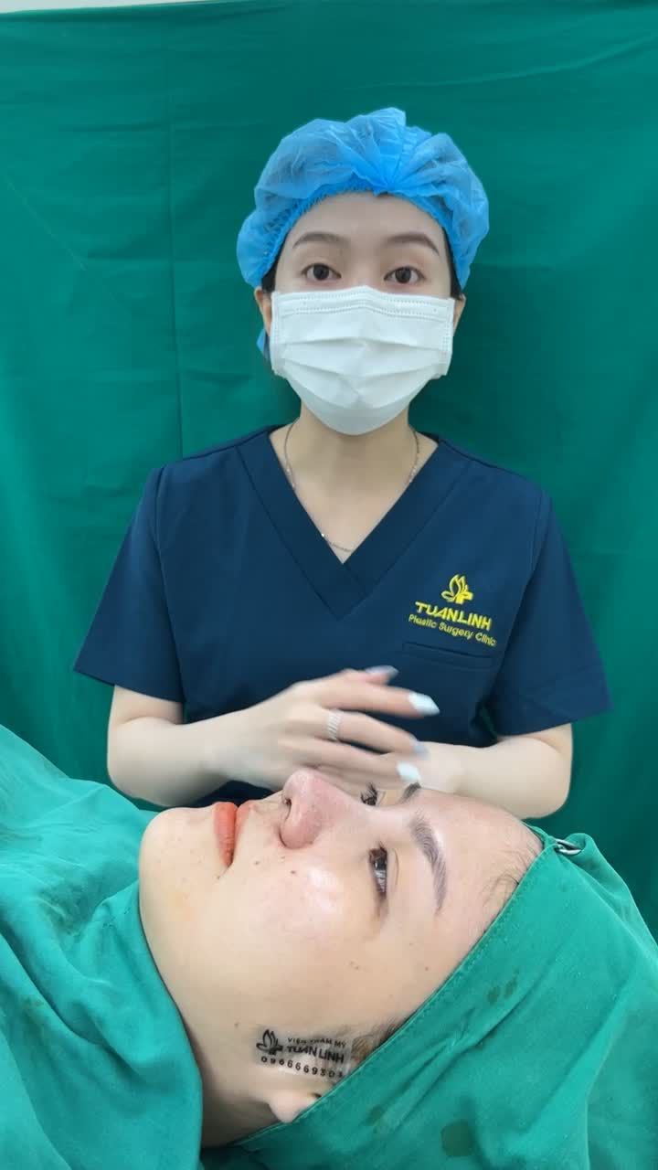 Case nâng mũi cấu trúc sửa lại sụn Surgiform hoàn thành sau 90  phút