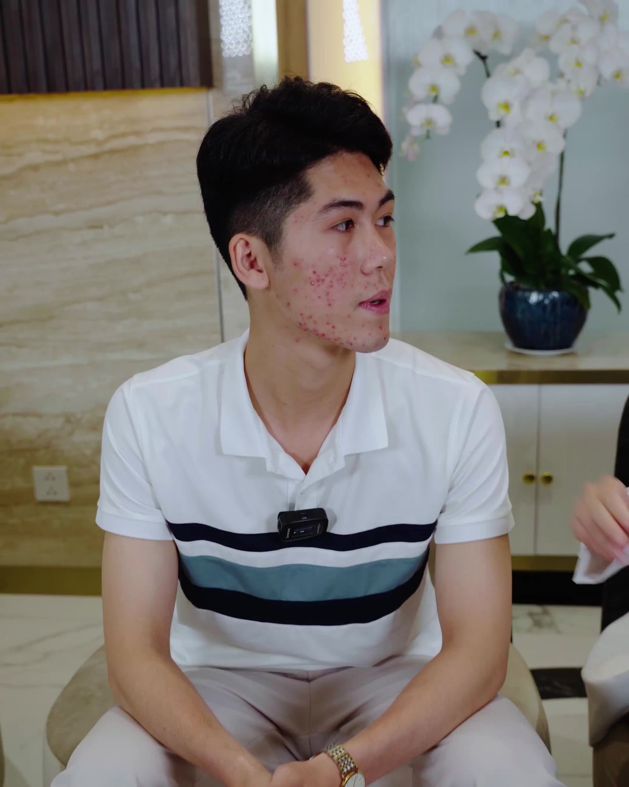 MỤN DẬY THÌ 7 NĂM RÒNG RÃ - TÂM SỰ CỦA NGƯỜI TRONG CUỘC