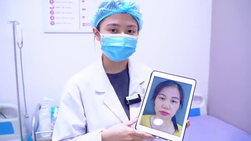 Combo Cắt mí + Nâng cung mày giúp khách hàng thay đổi vẻ đẹp đôi mắt như thế nào Mời cả nhà cùng đón xem