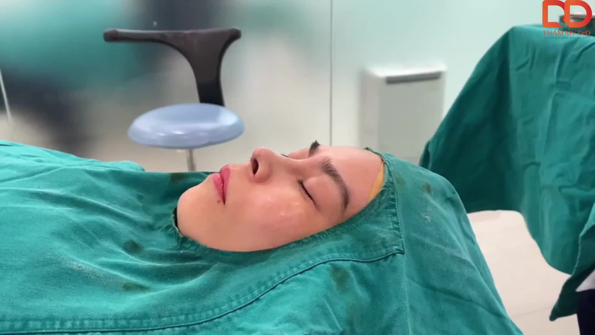 Không phải đợi lâu nữa cả nhà ơi, đã có kết quả ca nâng mũi Perfect Dform siêu đẹp rồi.