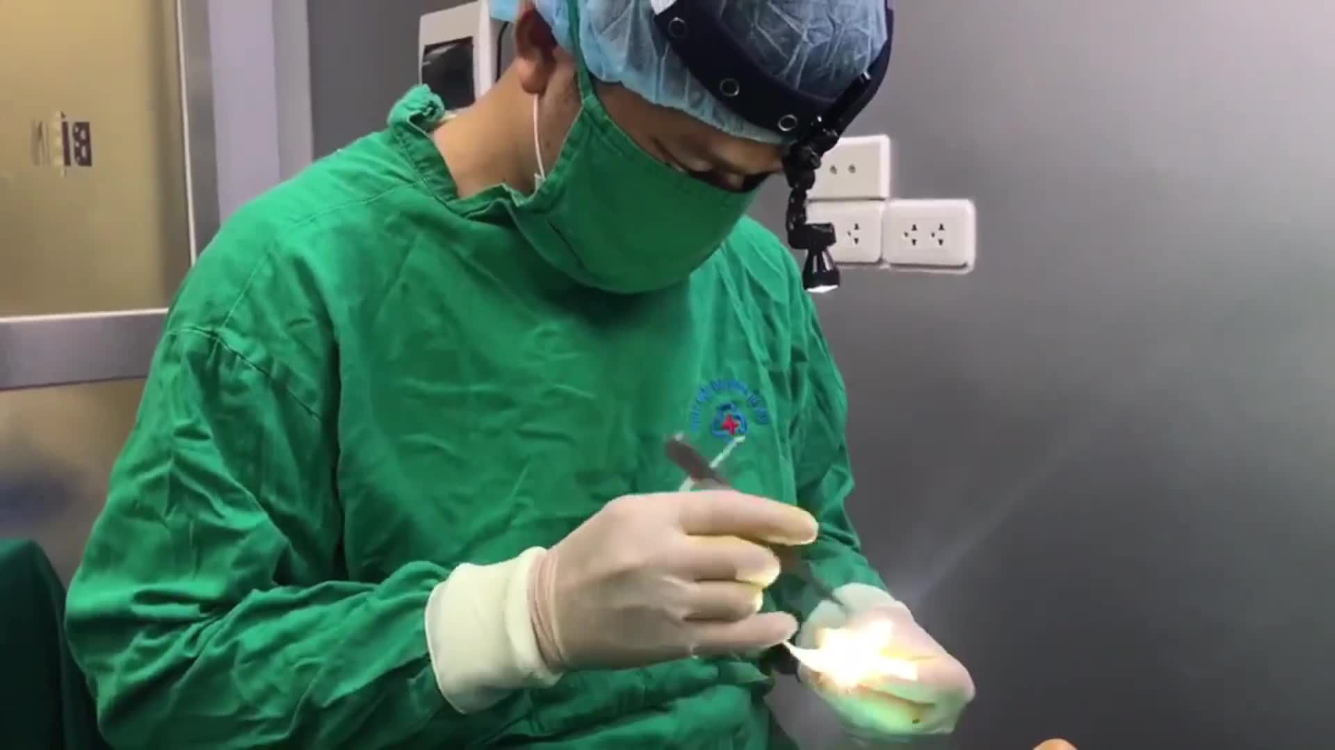 Độn cằm Vline - Đẹp bất chấp thời gian.