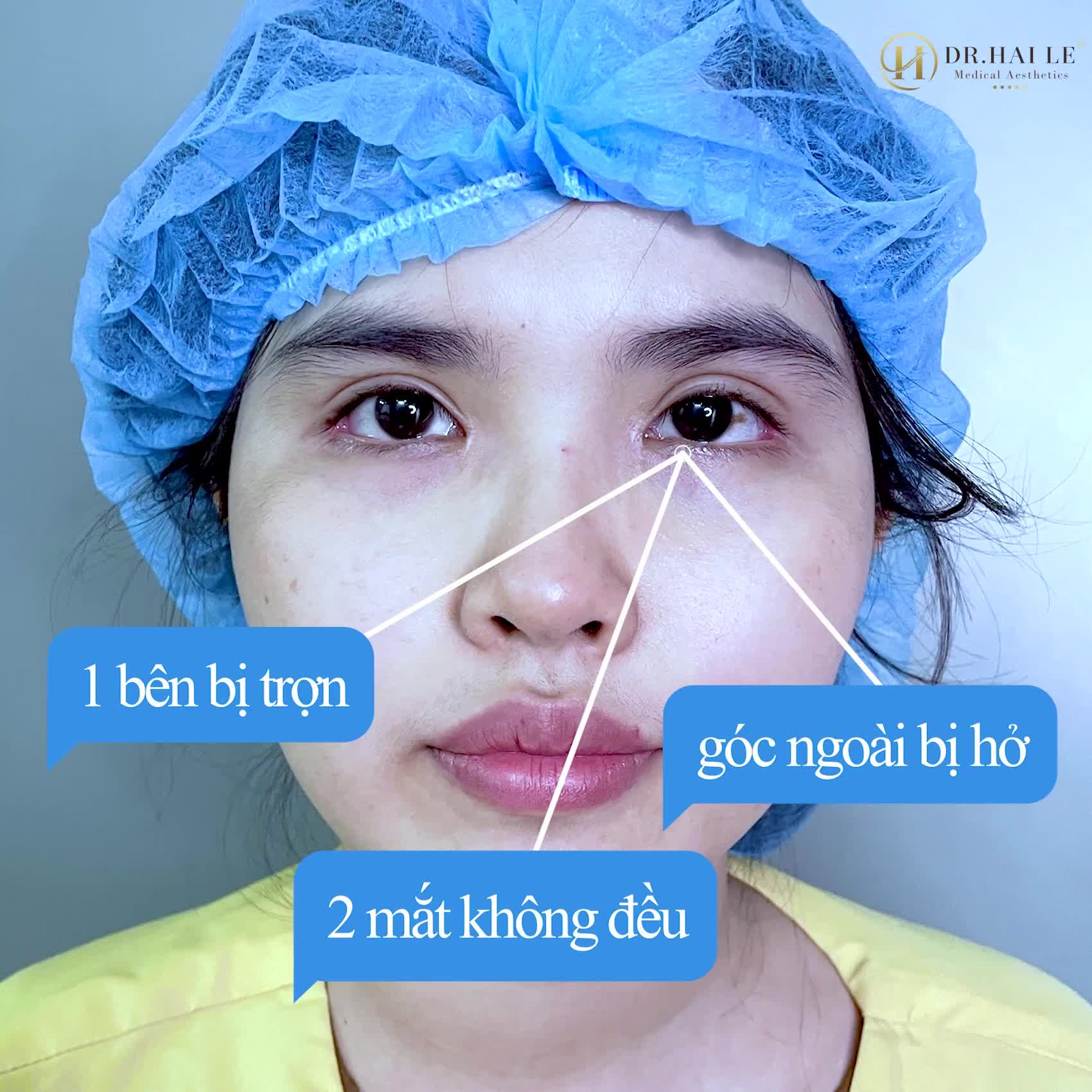 Ngày nào em cũng lên Dr.Hải Lê để xem có ca nào giống em không...