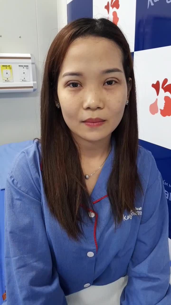 Đẹp mê li với kết quả cắt mí plasma