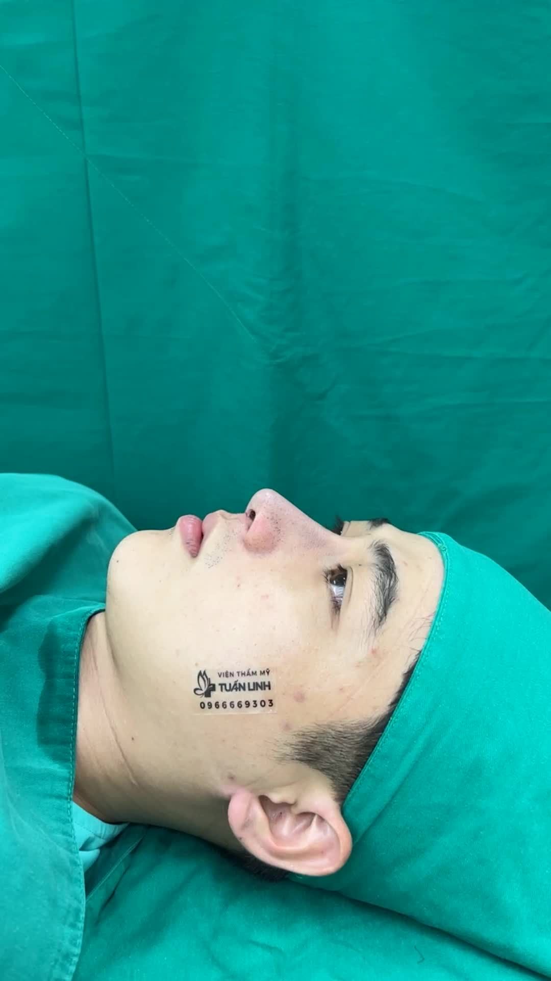 Từ Trà Vinh lên Sài Gòn nâng mũi - Chàng trai 9X nhận cái kết bất ngờ