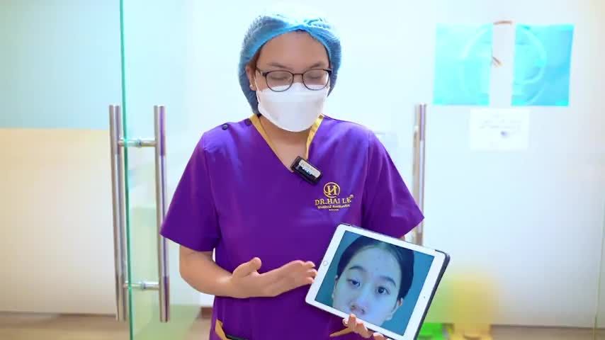 Dr.Hải Lê giải cứu mọi ca mí lỗi hỏng, mí sụp bẩm sinh, mí có các khuyết điểm cần khắc phục