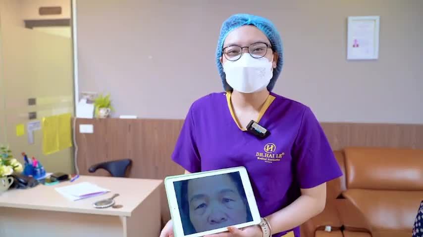 Nâng cung mày + Cắt mí giúp vị khách hàng trẻ trung rạng rỡ như thế nào Mời cả nhà cùng theo dõi