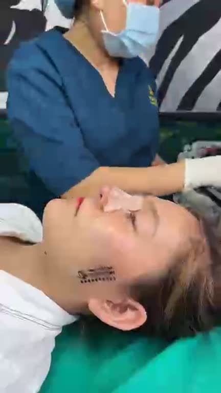 Mũi cấu trúc đẹp tự nhiên sau 10 ngày