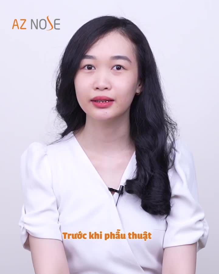 Không còn ngại chụp hình nhờ dáng mũi cực xinh
