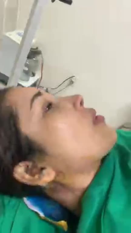 Ca cuối trong ngày tại SG sửa mũi hếch, lệch, thô cho bạn gái Gò Vấp bằng mũi cấu trúc (đầu mũi tự thân 100%) !