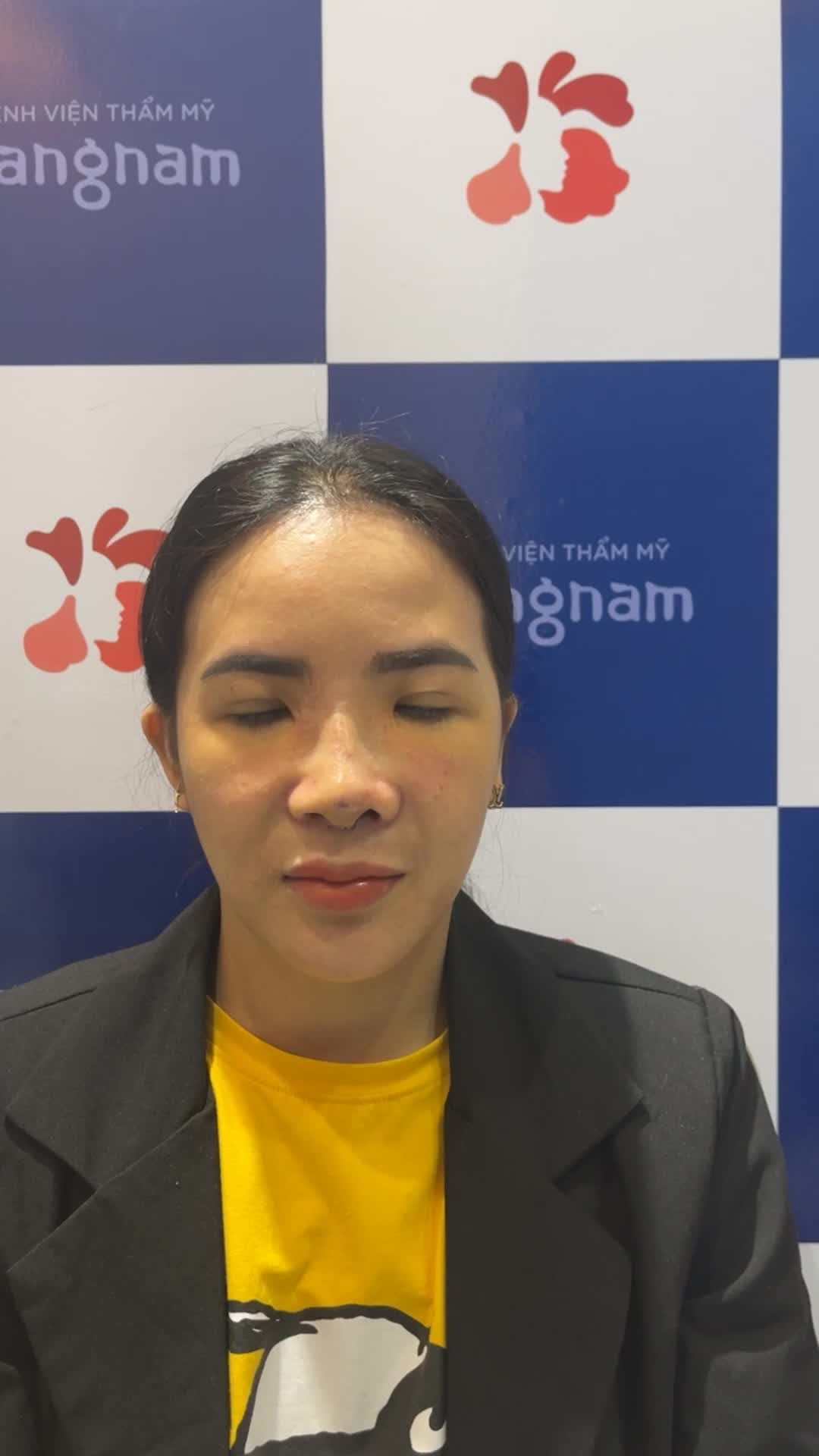 KH gặp tai nạn khiến mũi biến dạng - Tới Kangnam sắm 1 chiếc mũi mới
