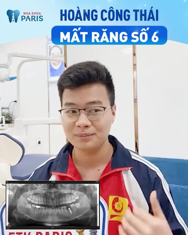 30 năm kiểm định – Trụ Implant ETK Paris dành riêng cho xương hàm người Việt