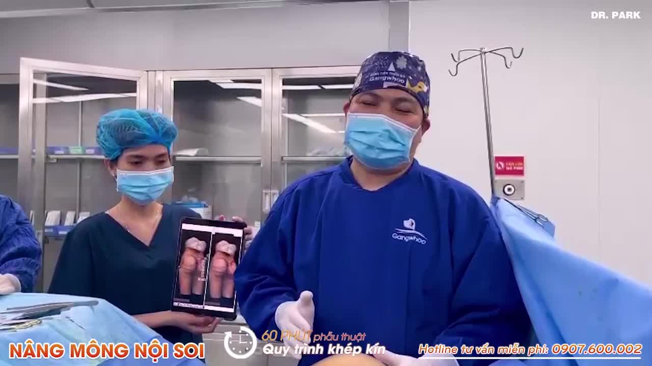 NÂNG MÔNG - BÍ QUYẾT TĂNG VÒNG 3 TRÒN GỢI CẢM