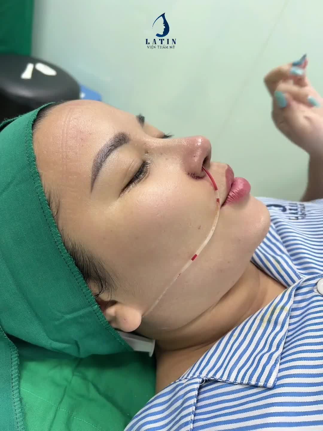 COMBO MŨI BÁN CẤU TRÚC PHONG THỦY KẾT HỢP ĐỘN CẰM