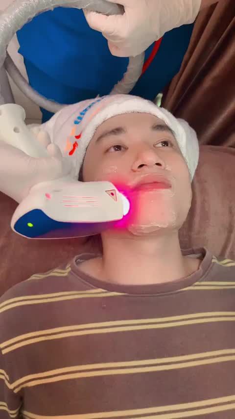 Quy trình triệt râu quai nón công nghệ Diode Laser của khách hàng nam lần thứ 5