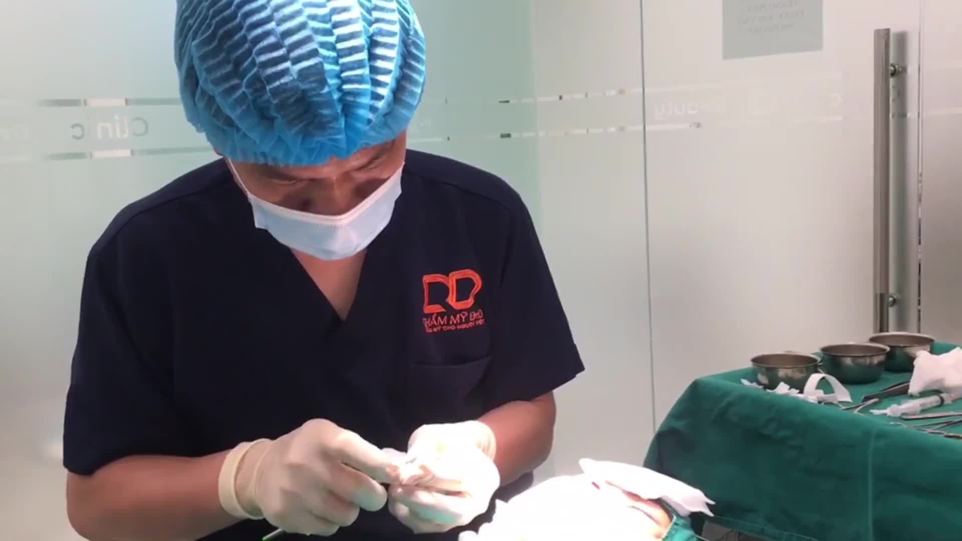 Bạn khách hàng trẻ sở hữu chiếc mũi thấp, đầu mũi tương đối to, tổng thể chiếc mũi thô, kém sang.
