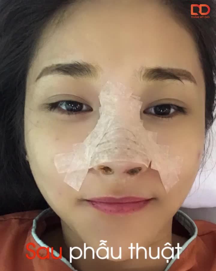 Trời xanh mây trắng nắng vàng Nàng không say nắng mà say dáng mũi Perfect Dform
