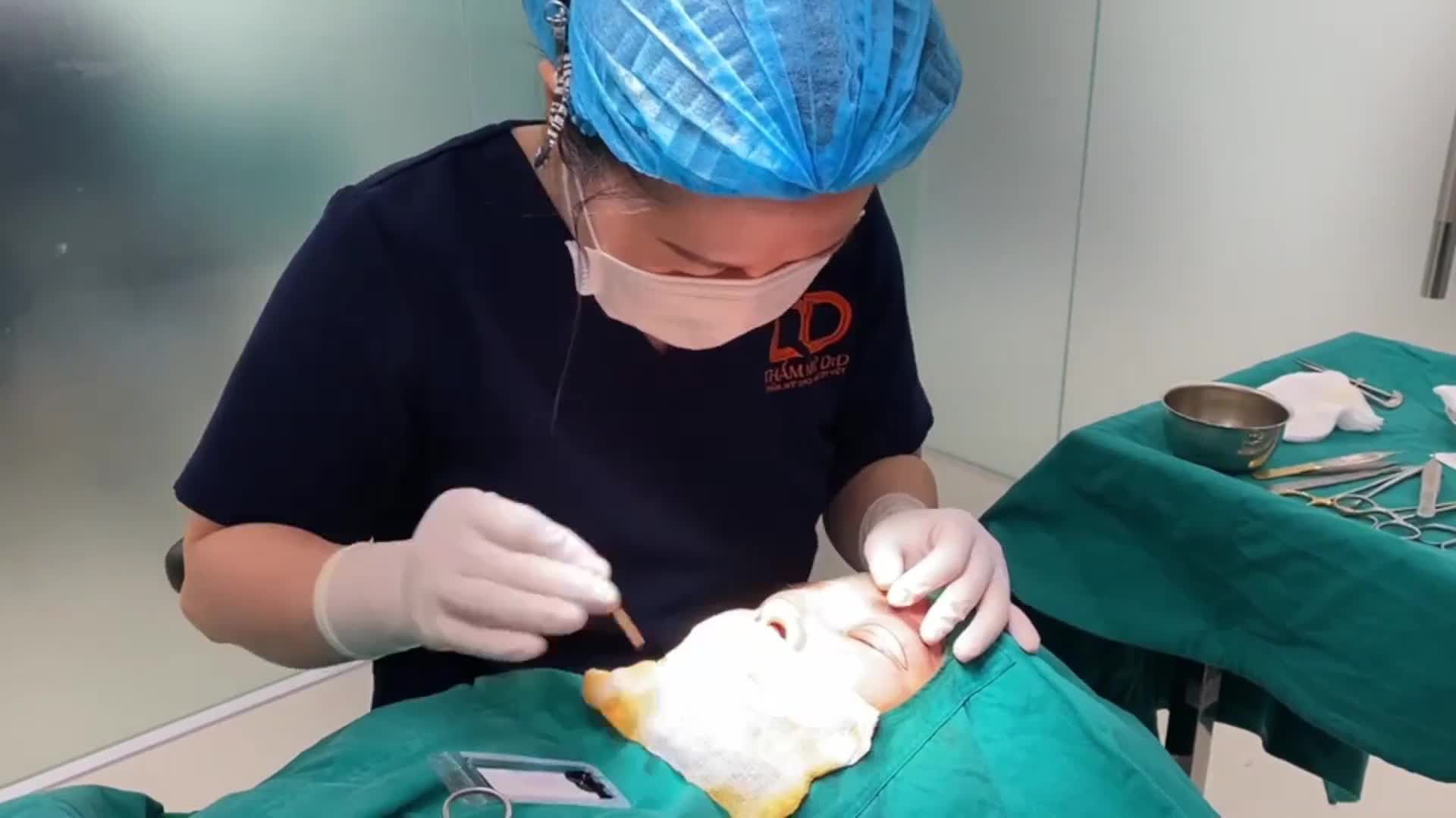 Khách hàng từng gặp phải tình trạng liệt cơ thần kinh mặt, mí mắt sụp, nhiều da thừa, 2 bên mí mắt to nhỏ khách nhau.