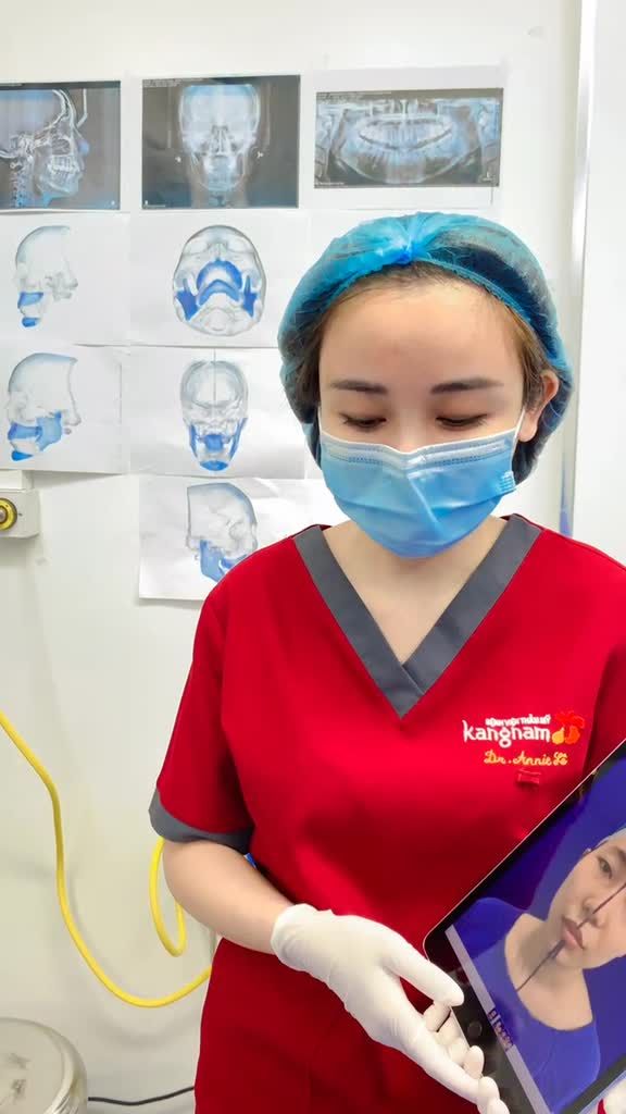 Em ơi, bác sĩ có ca hàm mặt quá là thay đổi, lên livestream luôn cho khách hàng xem em nhé