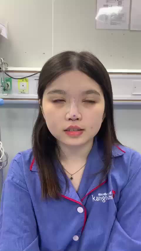 Mục sở thị khách hàng vừa làm xong nâng mũi Cấu trúc 4D tại Kangnam 666 Cách Mạng Tháng 8