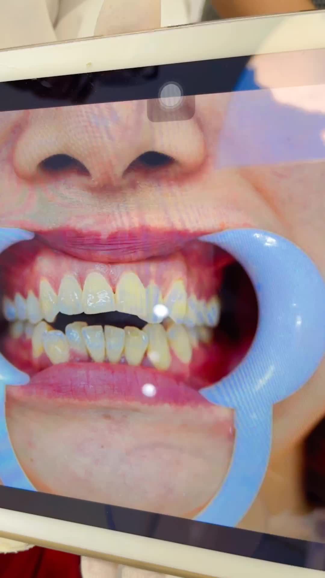 Cảm nhận của khách hàng sau 1 năm trải nghiệm dịch vụ niềng răng tại phòng nha KangNam Sài Gòn