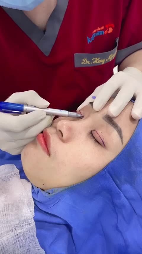 Chị em quan tâm cắt mí không thể bỏ qua livestream này!
