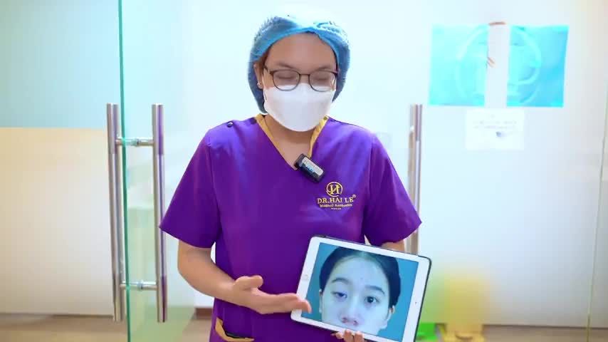 Sau 7 ngày được giải cứu khỏi đôi mắt sụp bẩm sinh + Lỗi hỏng em gái đã tự tin như thế nào sau khi gửi gắm đôi mắt cho Dr.Hải Lê