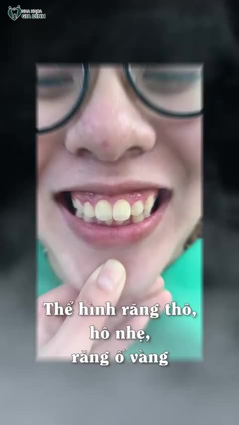 Cô ấy đã thay đổi để trở thành phiên bản tốt hơn của mình.