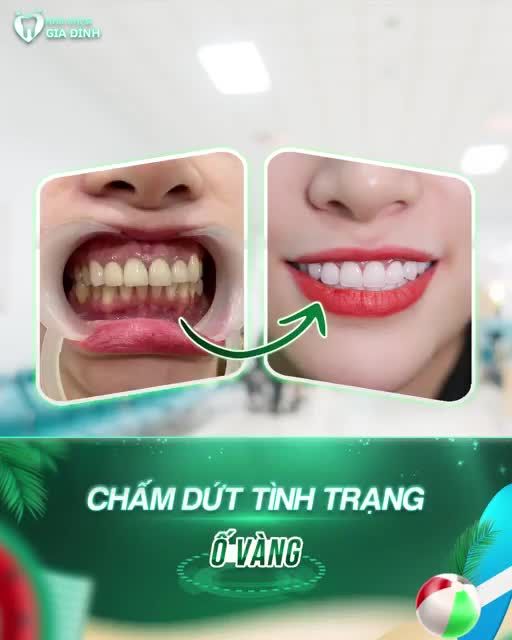 CƯỜI ĐẸP RẠNG NGỜI - LỜI NGAY TỚI 120.000.000