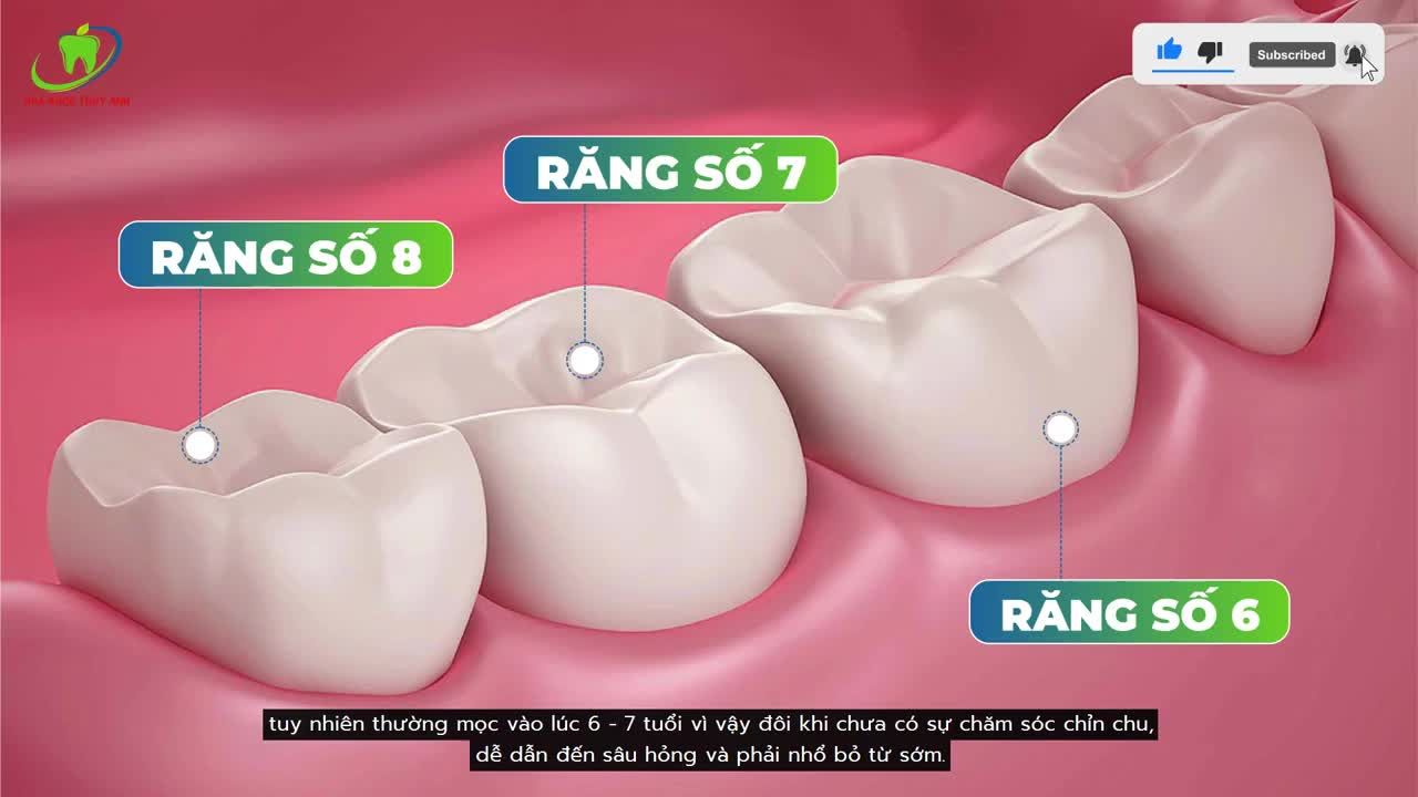 DỰNG TRỤC RĂNG - CHUẨN BỊ CHO DI GẦN RĂNG HÀM THAY THẾ RĂNG 6 ĐÃ MẤT