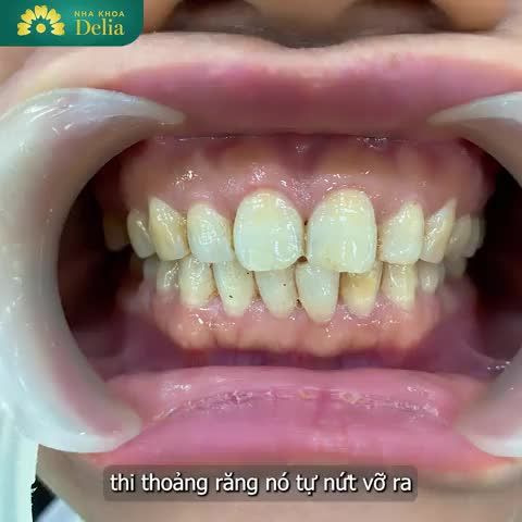 Khách hàng Phạm Ngọc Tân "say nắng" Delia vì bác sĩ quá nhiệt tình.