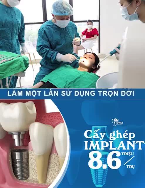 LỢI ÍCH KHI TRỒNG RĂNG IMPLANT