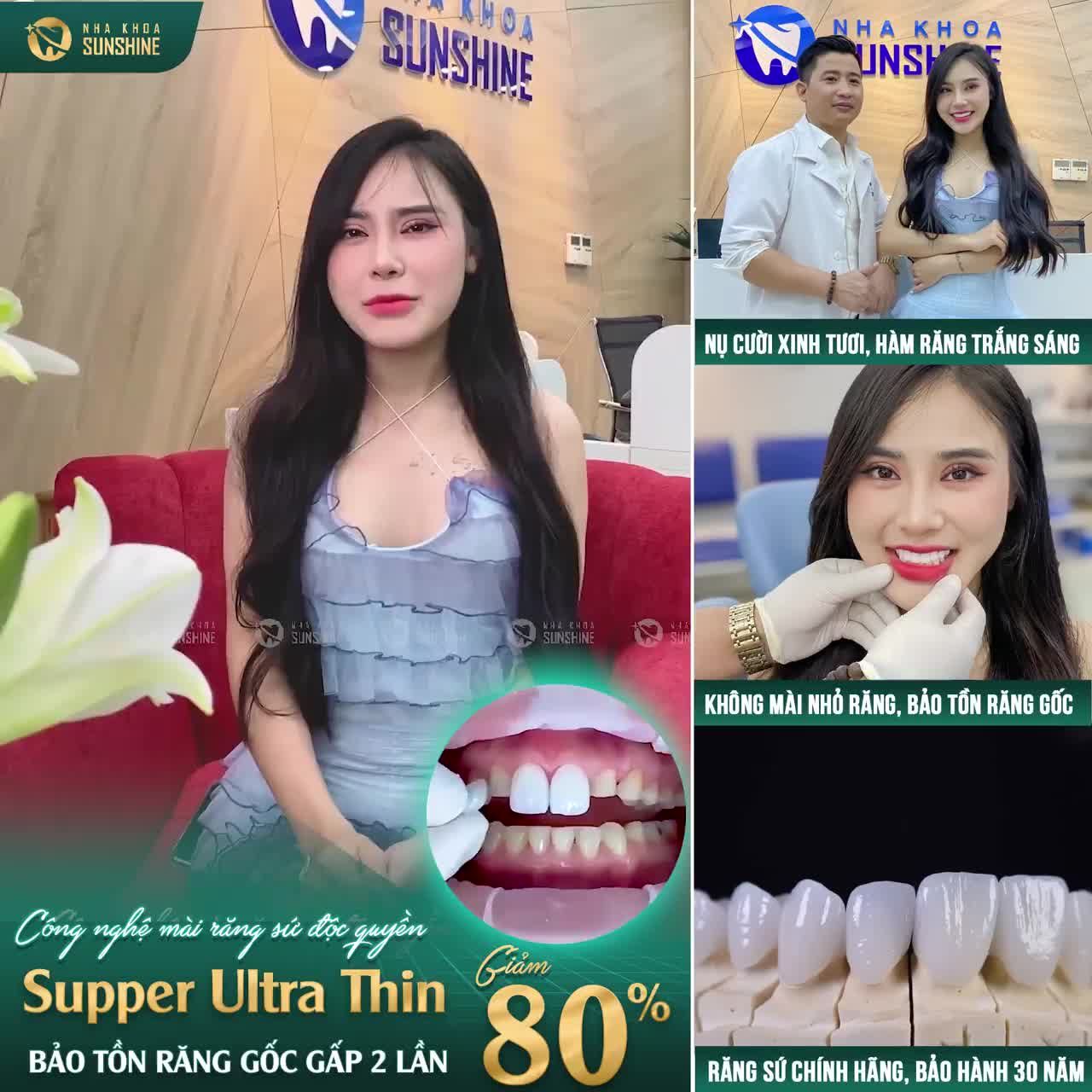 Mài răng ít nhất, không đau nhất và tối ưu nhất hiện nay giúp bảo tồn răng gốc gấp 2 lần so với phương pháp thông thường