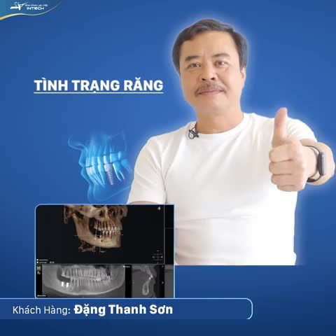MẤT RĂNG HÀM CÓ TRỒNG RĂNG IMPLANT BẰNG CÔNG NGHỆ SAFE - TECH ĐƯỢC KHÔNG