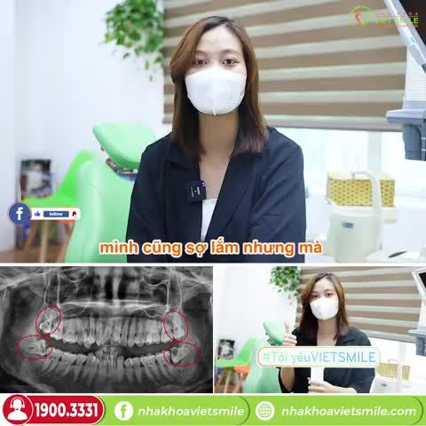 NHỔ RĂNG KHÔN MỌC LỆCH 90 ĐỘ KHÔNG ĐAU