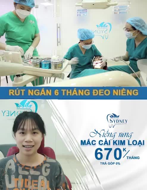 NIỀNG RĂNG KIM LOẠI - RẺ VÀ HIỆU QUẢ